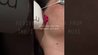 Moxi in Wilmington, NC | Self Skin Studio