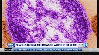 Measles outbreak grows to worst in 30 years