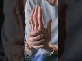 Carpal Tunnel Syndrome Explained – Know the Warning Signs | Dr Nikhil Dongre