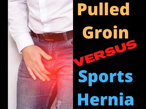 Pulled groin versus