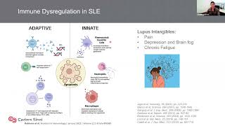 UW Rheumatology Grand Rounds - Caroline Jefferies, 5/9/2023