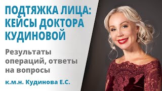 Подтяжка лица: кейсы доктора Кудиновой и ответы на вопросы