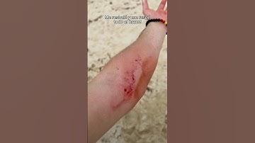 Me ELECTROCUTÉ intentando algo muy extremo!!💀⚠️⚡️