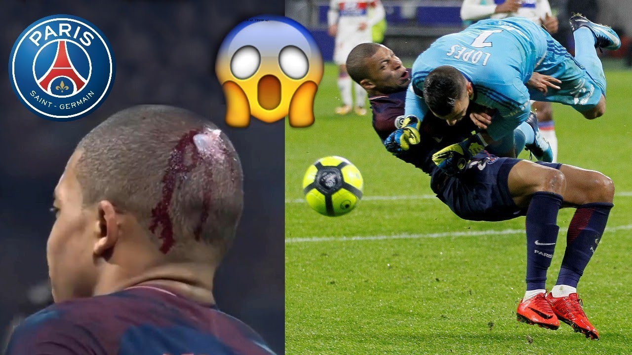 Les Blessures les plus Impressionnantes de Kylian Mbappé au PSG 😱 YouTube