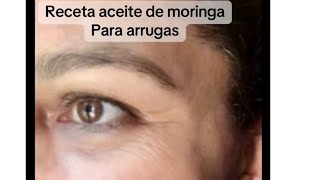 Receta De Moringa Para Arrugas De Albatips