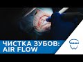 Чистка зубов Air Flow