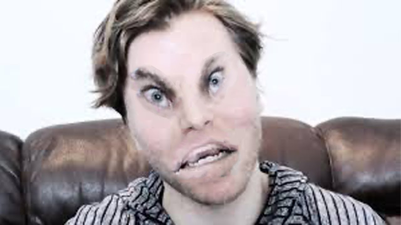 Onision but every time he is Onision the video gets more distorted