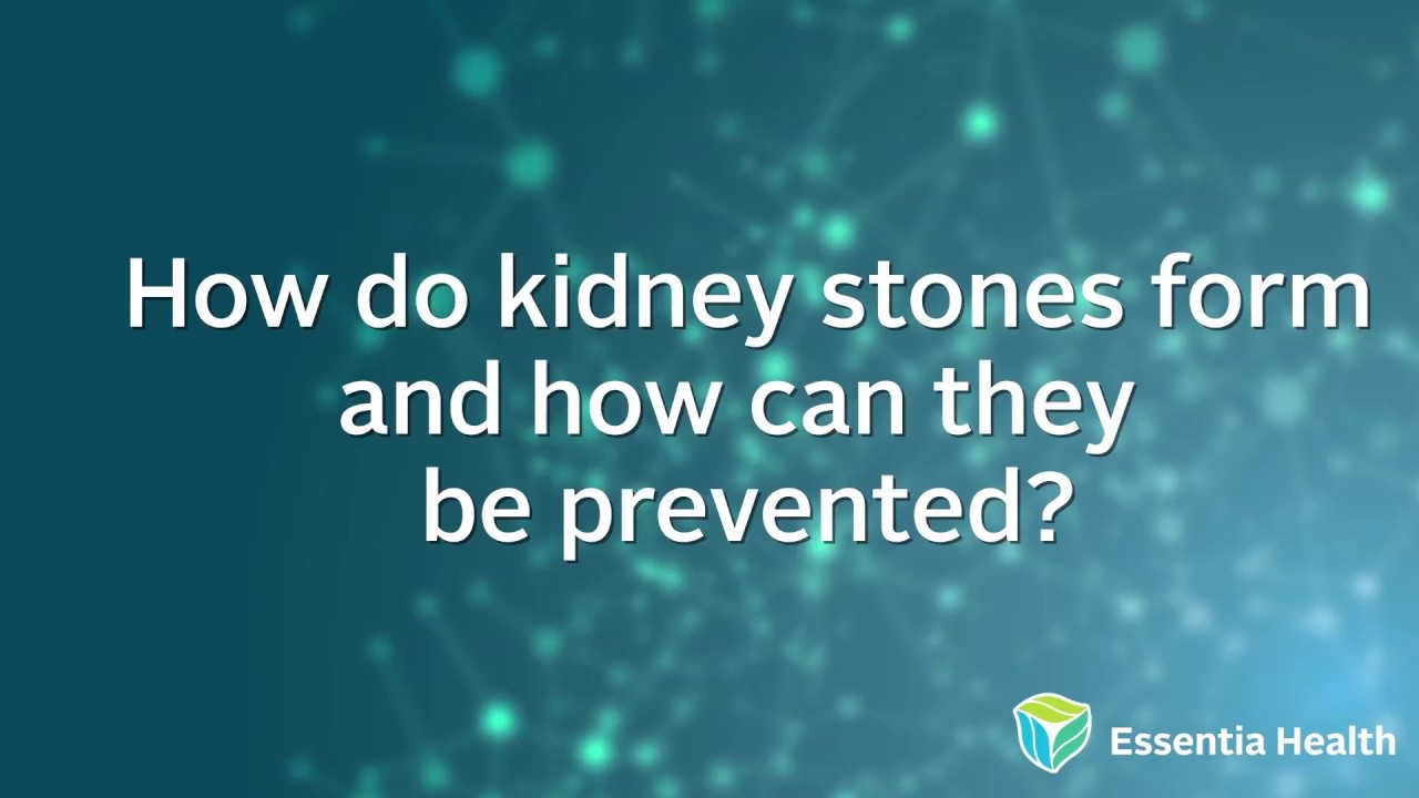 Urology How Kidney Stone Form Essentia Health YouTube