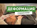 Воронкообразная деформация грудной клетки