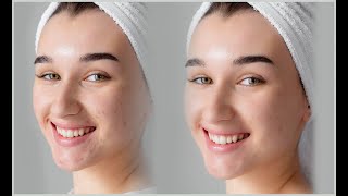 Face Retouching - easy Photoshop Tutorial - Skin Retouching