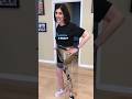 Taking Steps Forward: The Journey of Transtibial Amputees with Prosthetic Limbs