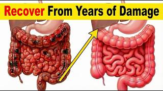 Gut RESET (Simple Plan)