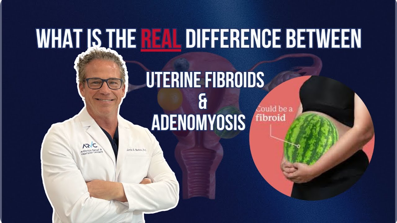Fibroids vs. Adenomyosis | What Every Woman Needs to Know!