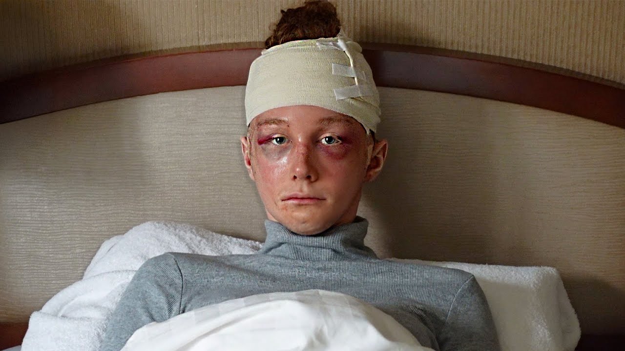 My Sister Had MORE Facial Feminization Surgery in South Korea | Season 2, EP 1