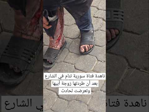 ناهدة فتاة سورية تنام في الشارع بعد أن طردتها زوجة أبيها و تعرضت لحادث وتعاني بصمت 0096394012755