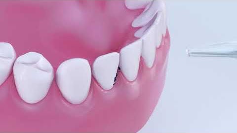 Electric Water Flosser-Oral Irrigator 3d product animation