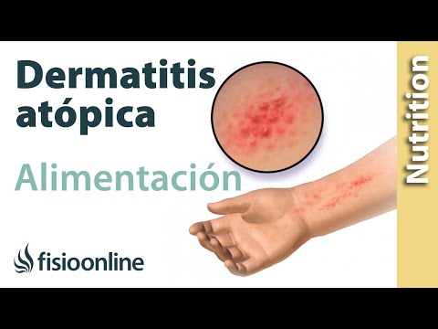 Video: Dieta para la dermatitis atópica en niños y adultos