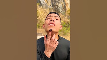 How I Cured a Bug Bite with Yogurt in the Wild Survival Hacks