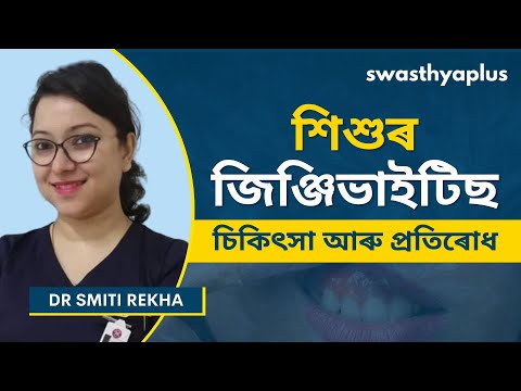 জিঞ্জিভাইটিছ: চিকিৎসা আৰু প্ৰতিৰোধ | Gingivitis: Treatment and Prevention, Assamese | Dr Smiti Rekha