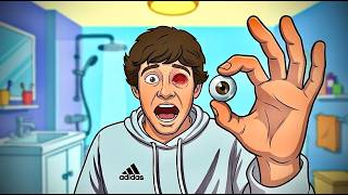 HOW TO REMOVE YOUR PROSTHETIC EYEBALL (Step By Step) Removing My Prosthetic Eye