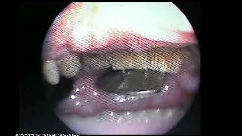 Chapter 2: 01 EMBOUCHURE: Inside Out