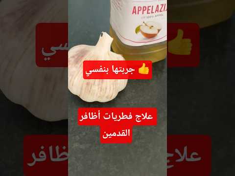 علاج فطريات أظافر القدمين مجربة