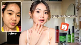 NEW SKINCARE FROM SHOPEE? for acne prone & sensitive skin ft. COMMONLABS.