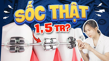 [HOT] Giá Niềng Răng Mắc Cài Kim Loại 2024| Chỉ 1 Phút Đầu Video Biết Ngay Bạn Hết Bao Nhiều Tiền?