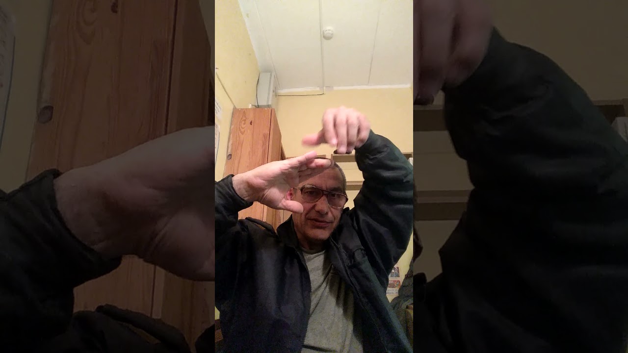 Лечение контрактуры Дюпюитрена без операции - YouTube