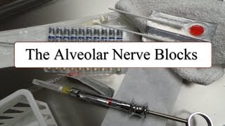 The Alveolar Nerve Blocks