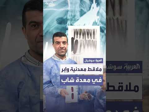 استخراج أجسام غريبة من شاب في السليمانية بكردستان العراق