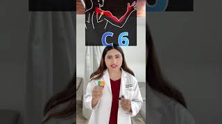 How to identify cervical nerve root radiculopathy #thephysiocoplus #physiotherapy #cervicalpain
