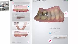 3Shape Communicate - 歯科医 - を使用した技工所間コミュニケーション - Dentist - Lab Communication