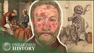 The Gruesome Diseases That Plagued The Medieval World | Medieval Dead | Unearthed History