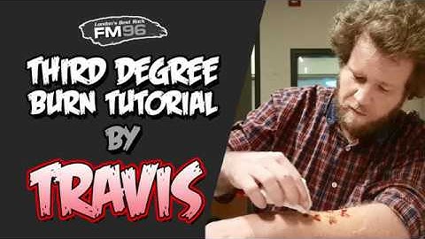 How To Make Fake Third Degree Burns for Halloween