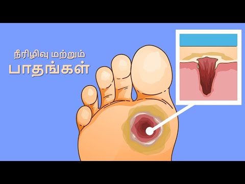 நீரிழிவு மற்றும் பாதங்கள் | Diabetes and Feet | 3D Animation in Tamil (தமிழ்)