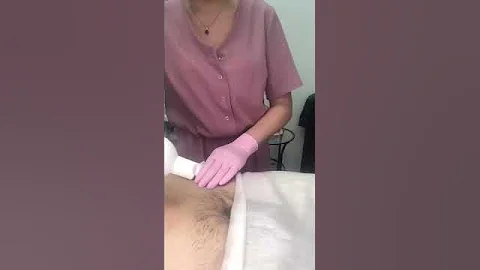 Мужская депиляция