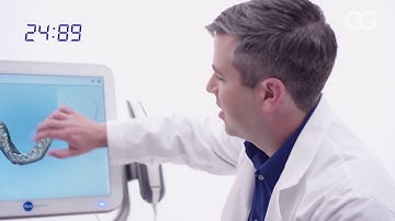 iTero Element® Digital Intraoral Scanner | Invisalign
