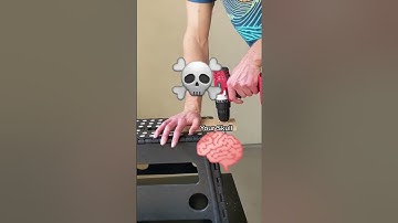 🧠 💀 How a Neurosurgeon drills through your skull and doesn