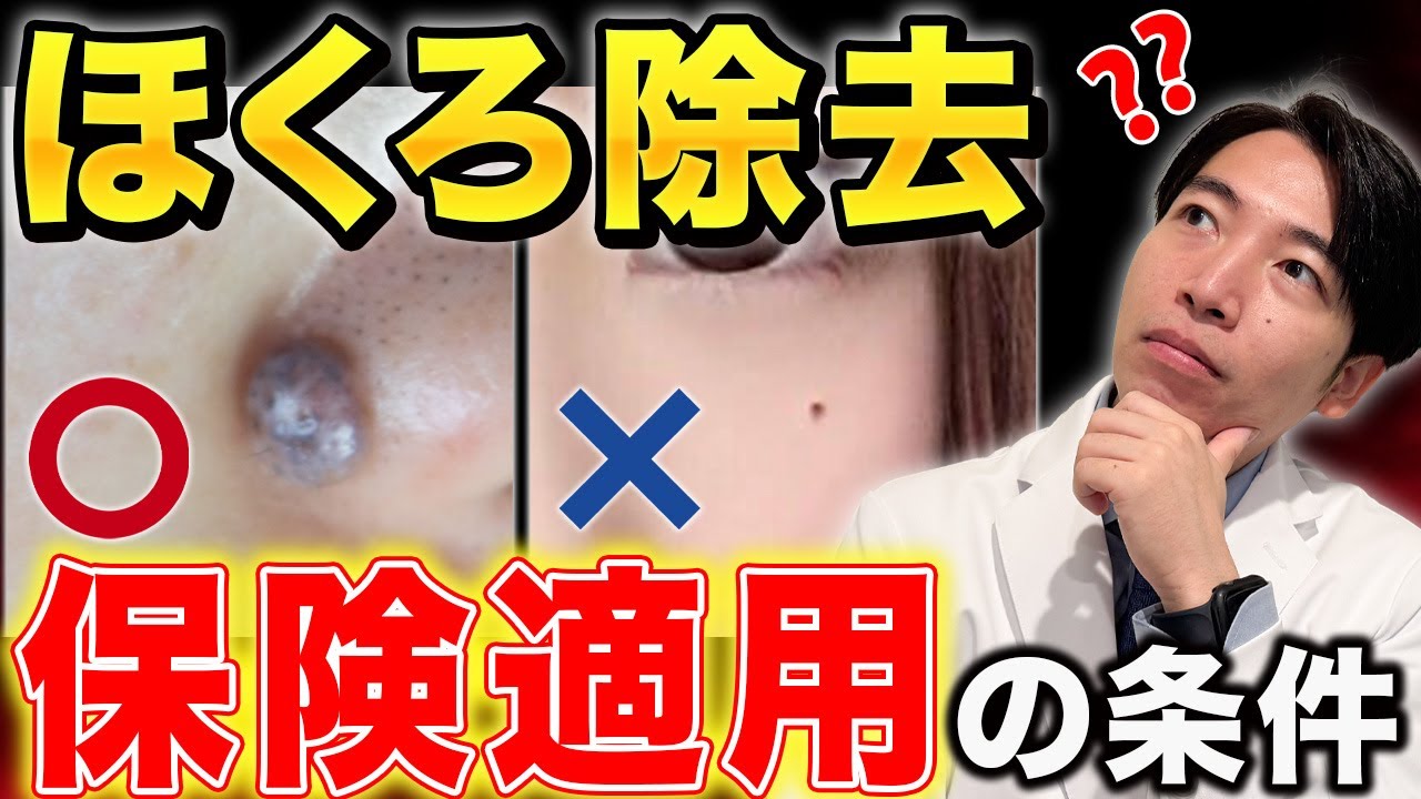 ほくろ 除去 保険 適用
