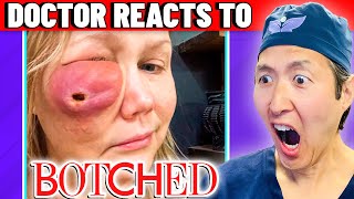 Plastic Surgeon Reacts To Botched Facial Fillers Did This??