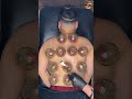 Cupping Therapy Session 💆‍♂️ | Natural Healing &amp; Muscle Recovery