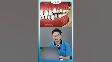 Răng Nhiều Khe Thưa Nguy Hiểm Như Thế Nào | Nha Khoa Minh Châu