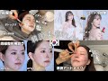 【韓国vlog🇰🇷】2泊3日美容旅行✈️詳細費用公開💰肌管理/涙袋アートメイク/両顎検診/アイドル体験/ごはん🐷/江南エリア/有益情報超詰め込みました🫡✨#2