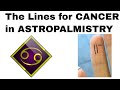 Astropalmistry: Cancer