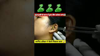 😱🐍लड़की के कान में घुसा किंग कोबरा सांप😱asmr balveer tik tok vedio bhoot🙏#shorts #viral #trending