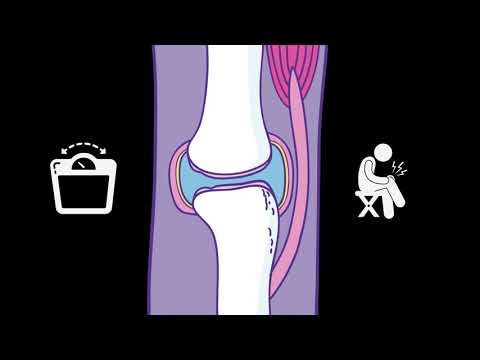 Video: Is artro een voorvoegsel?