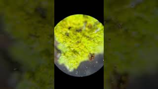Lichen Under The Microscope