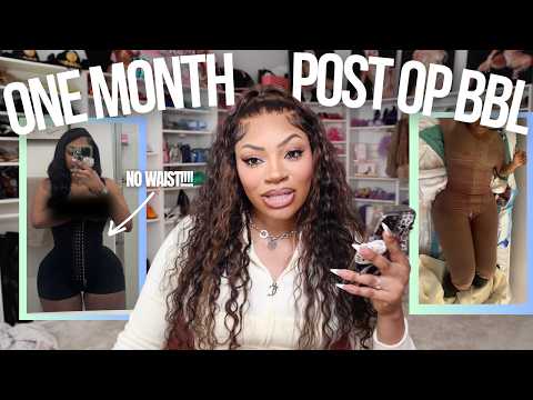1 Month Post-Op  BBL Q&A… The Truth They Don’t Tell You 😳