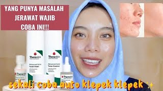 REVIEW JUJUR THERASKIN FOR ACNE SKIN ✨🫣